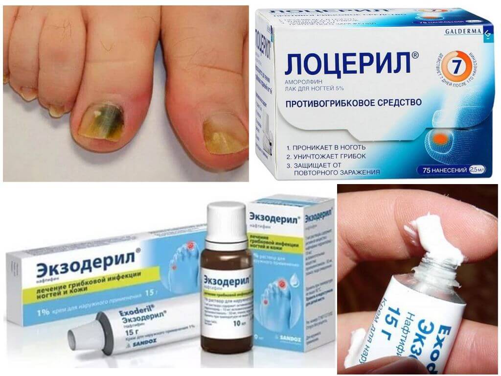 Рейтинг средств от грибка ногтей: топ 15 эффективных средств