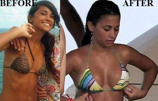 Antonella roccuzzo is messi's wife. hot photos in a swimsuit, before and after plastic surgery, figure
