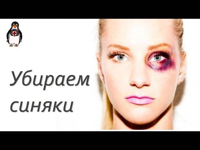 Как убрать синяк под глазом у ребенка за один день - mums.ru