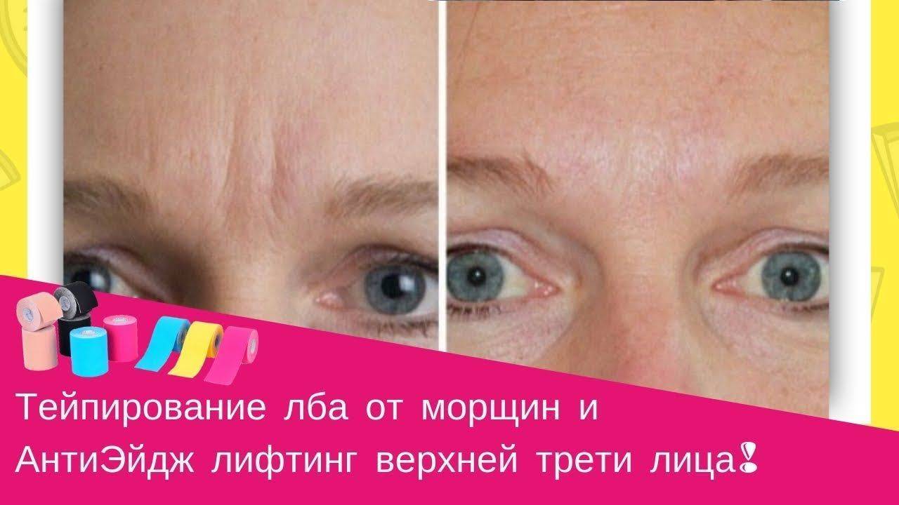 Тейпирование лица: лучшие схемы + 5 советов