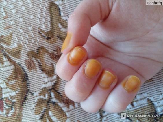 Маска для ногтей с йодом в домашних условиях