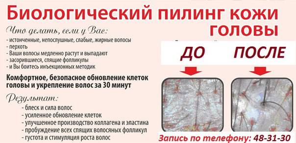 Скрабы для кожи головы: 15 домашних рецептов - от перхоти, с солью, кофе, содой - glamusha