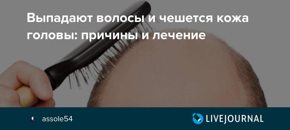 Зуд головы и выпадение волос: причины и лечение недуга у женщин народными средствами | mfarma.ru
