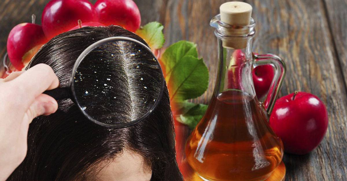Какие травы защищают от выпадения волос? | volosomanjaki.com