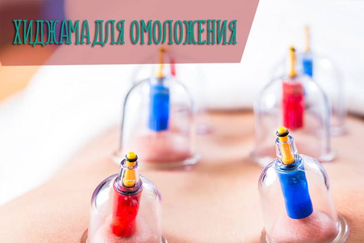 Хиджама на лицо до и после