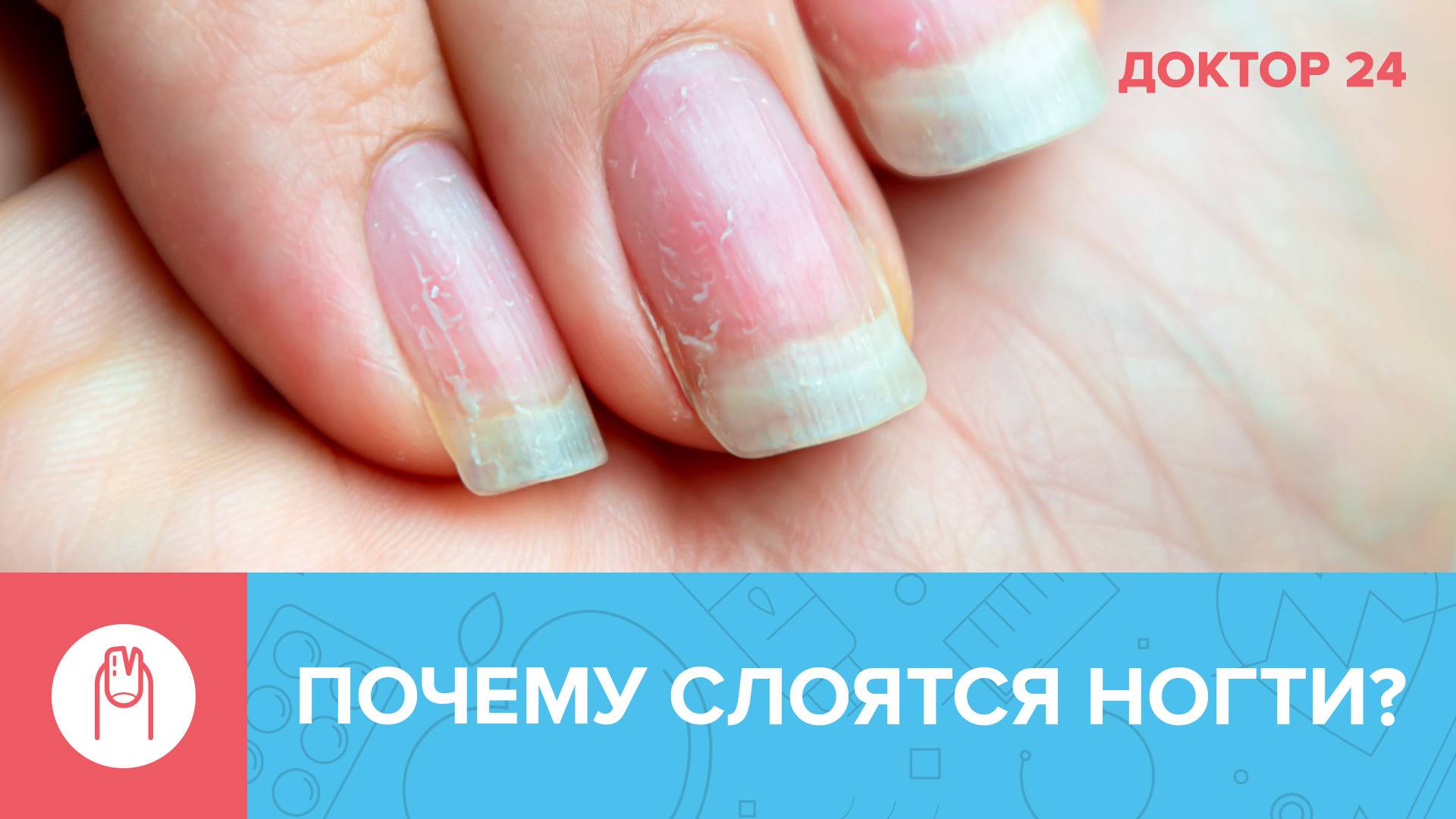 Слоятся ногти. причины слоения и лечение. видео.