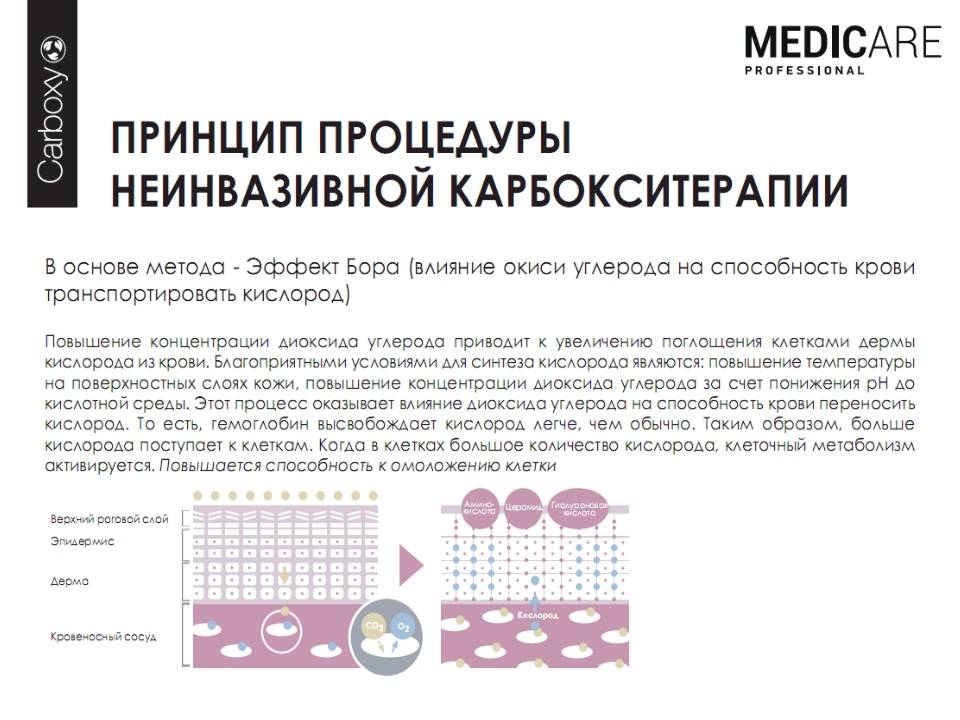 Газовые уколы (карбокситерапия) – реальная правда о процедуре