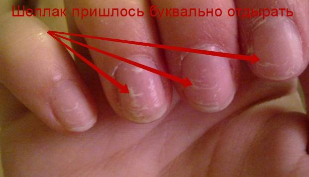Секреты маникюра: вредно ли наращивать ногти