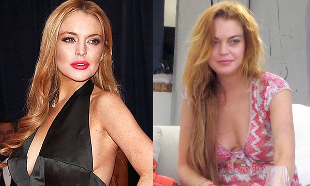 Did lindsay lohan get plastic surgery?
