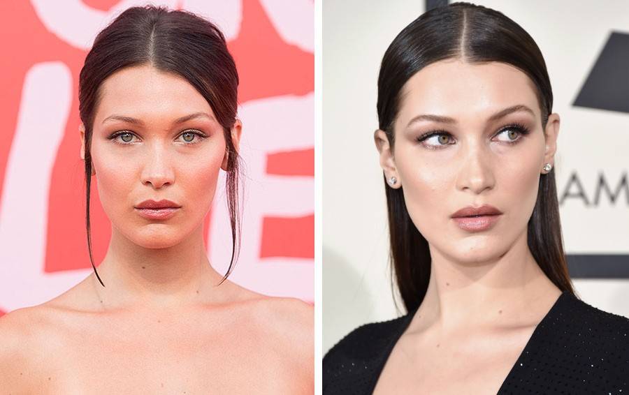 Bella hadid plastic surgery secrets exposed!