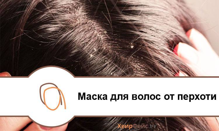 Сода от перхоти