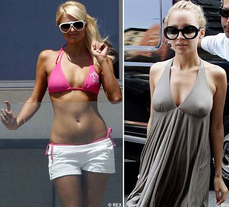 Paris hilton before and after plastic surgery journey