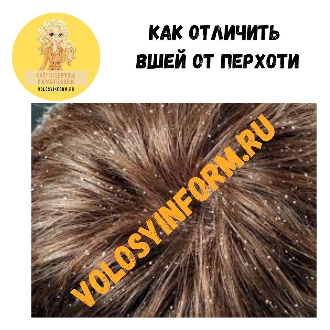 Вши у ребенка: что делать, как они выглядят в волосах у детей с фото?