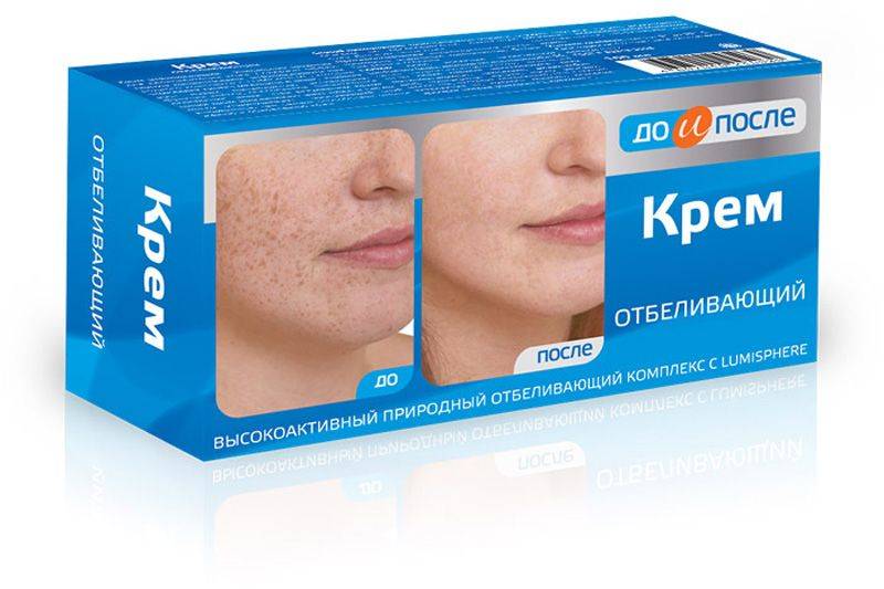 Самые лучшие отбеливающие крема для лица от пигментных пятен