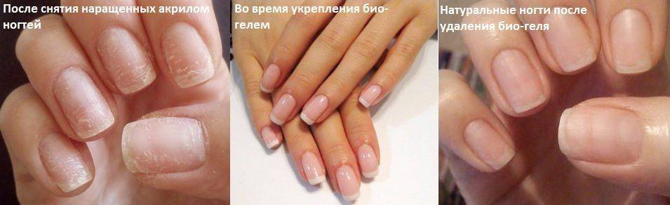 Чем отличается современный биогель от гель лака