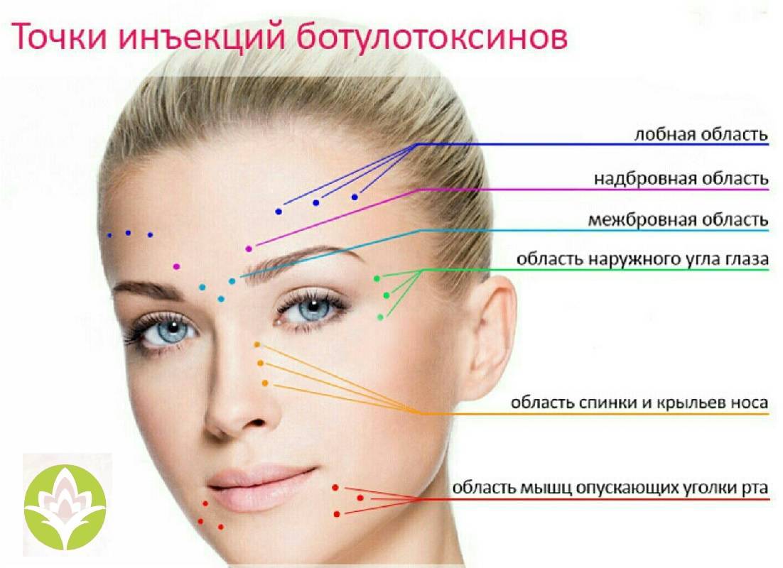 Мезоботокс: отзывы, фото до и после