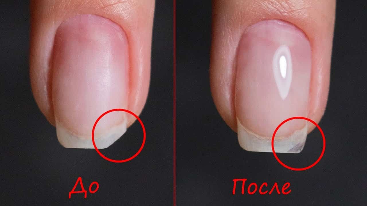 Что делать когда сломался ноготь до мяса: советы 