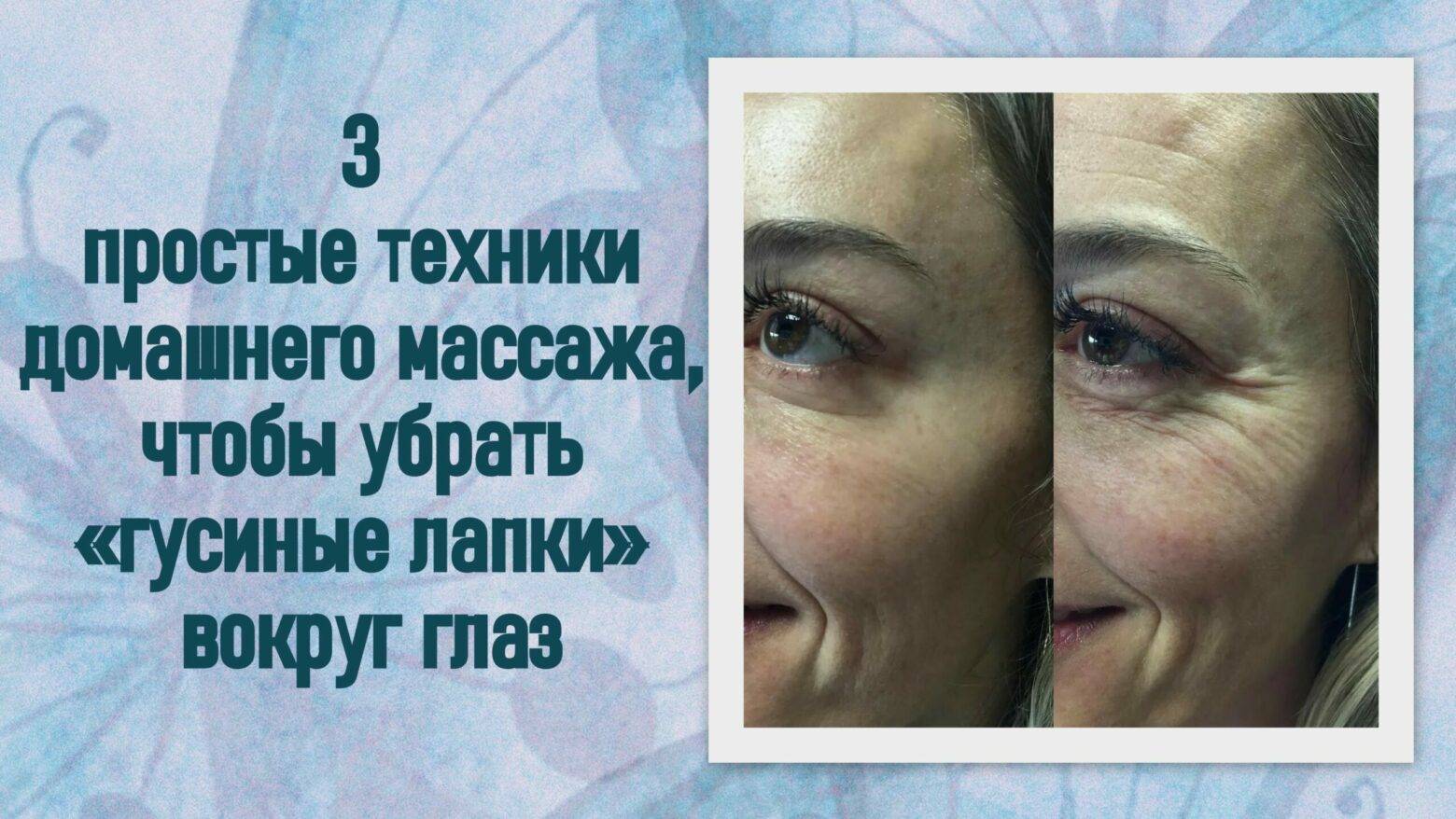Упражнения от гусиных лапок вокруг глаз – 6 методов чтобы убрать