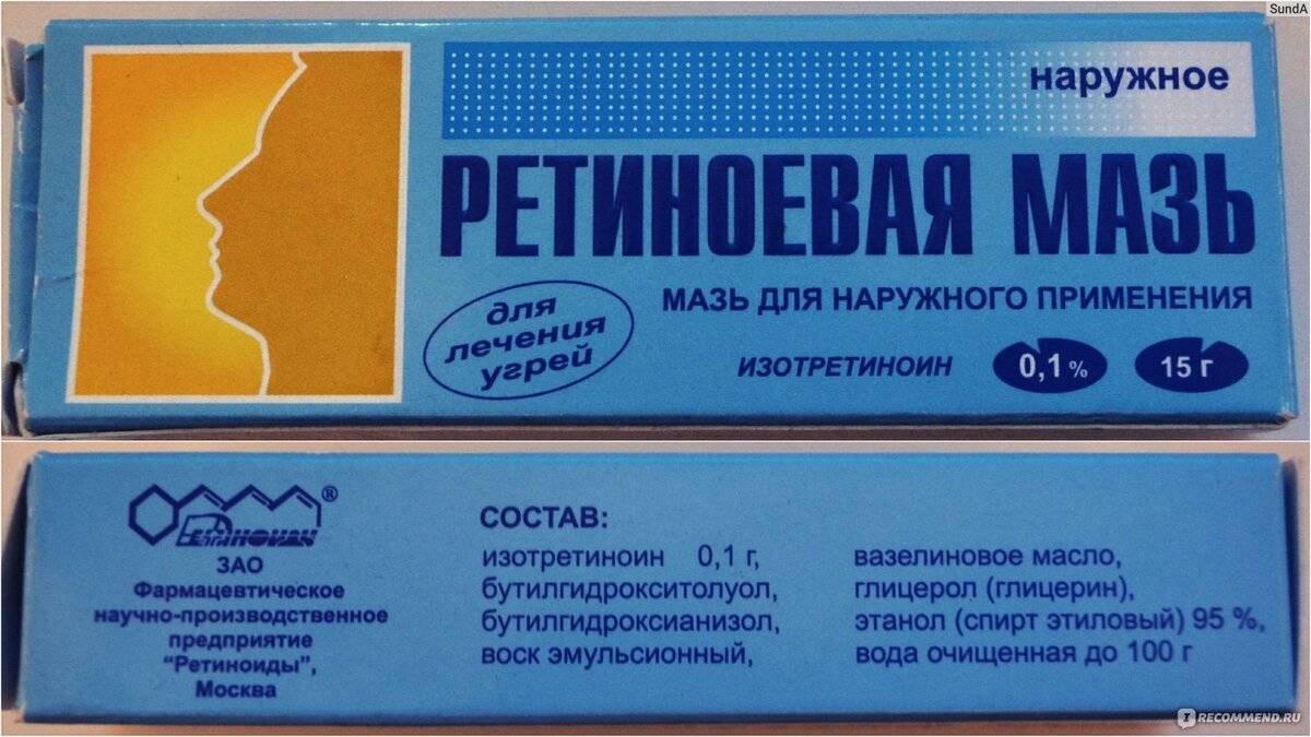 Бюджетные мази от морщин из аптеки - замена дорогим кремам!