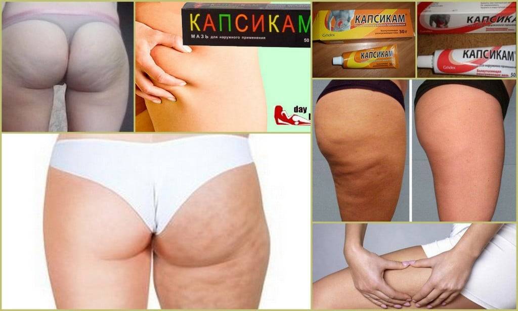 Обертывание с кофеином в ампулах. 3 обертывания от целлюлита на кофеине. | здоровье человека