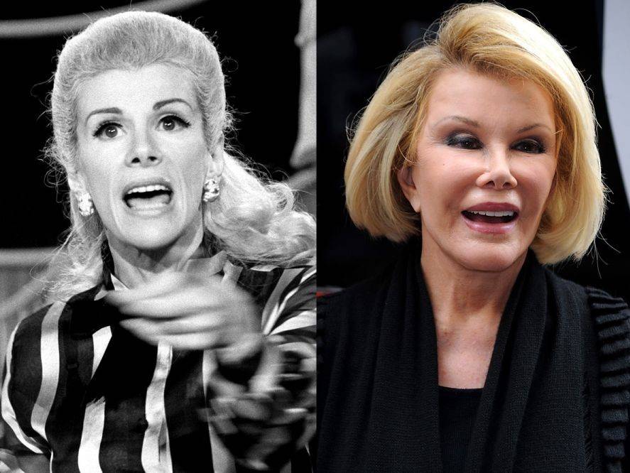 Joan rivers before plastic surgery pictures