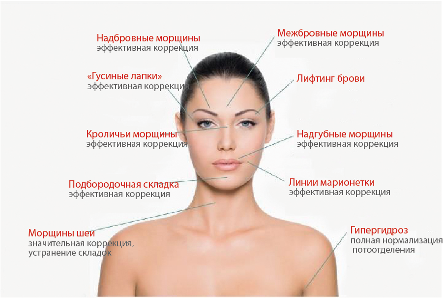 Ботокс в межбровье. избавление от морщин с помощью уколов