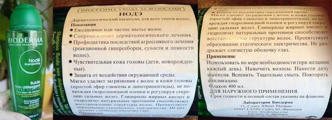 Какой выбрать шампунь от псориаза на голове? обзор средств и отзывы
