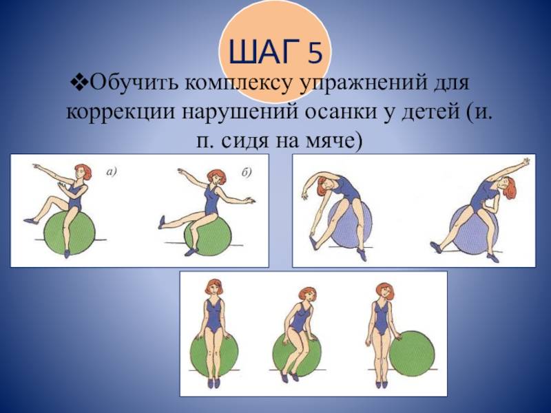 Как выпрямить осанку мужчине самостоятельно: комплекс упражнений