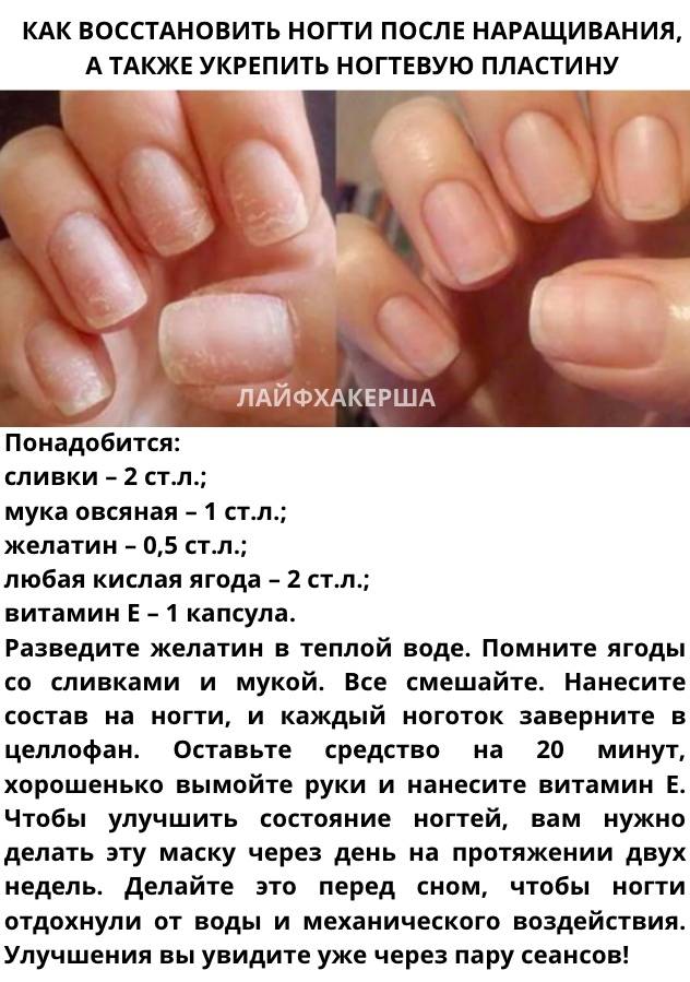Рецепт для ногтей для роста. домашние рецепты для быстрого роста ногтей. | маникюр