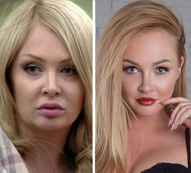 Дарья пынзарь до пластики, результаты после для лица | marykay-4u.ru