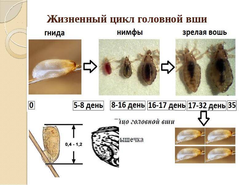 Как быстро размножаются вши: жизненный цикл