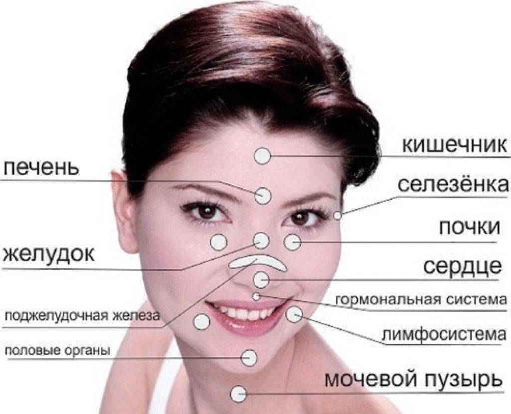 Прыщи на нижней части лица. Прыщи на подбородке орган. Прыщи и высыпания на лице у женщин.