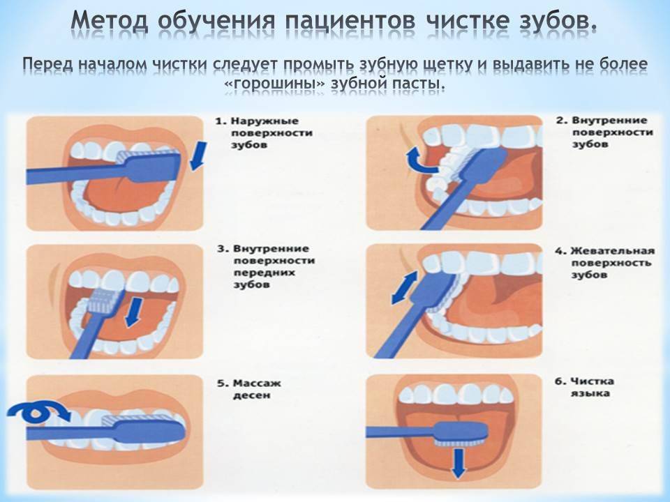 Гигиена полости рта