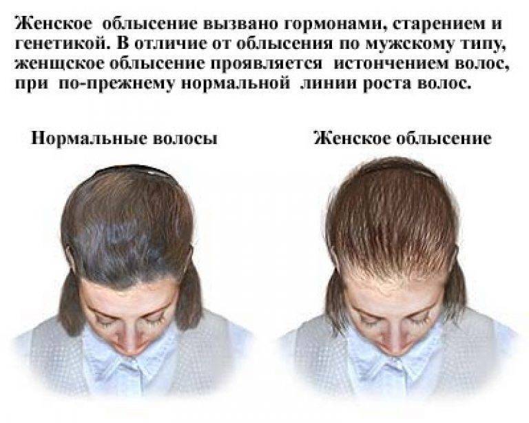 Причины выпадения волос летом
