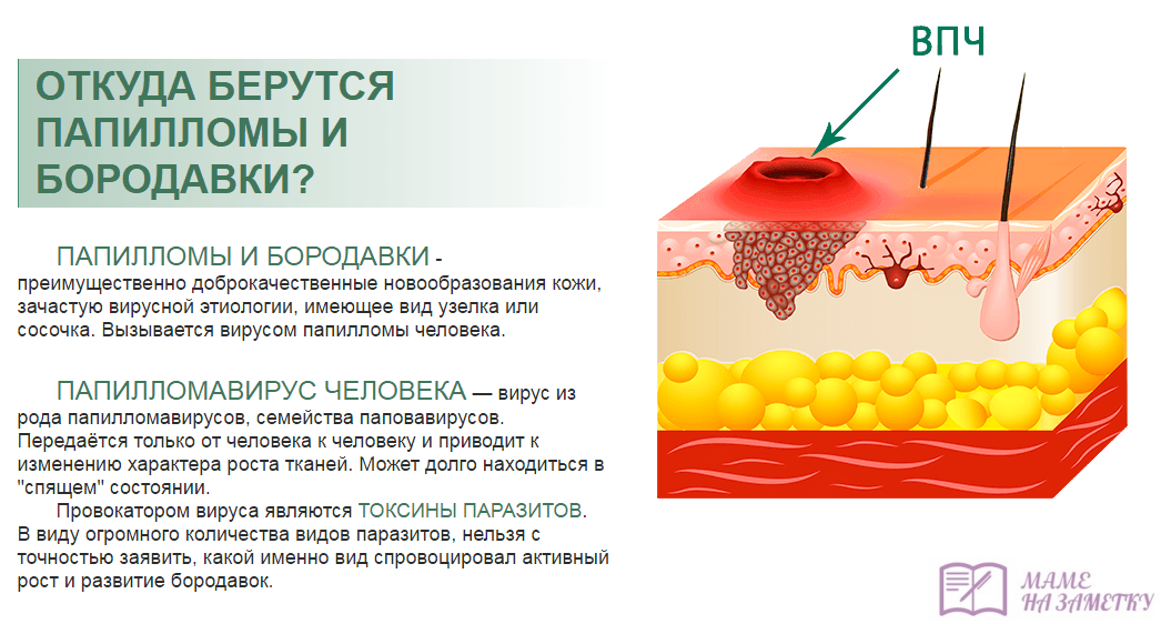 Лечение папиллом народными средствами