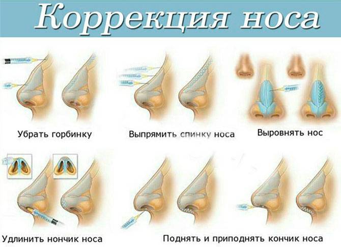 Как уменьшить широкий нос с помощью макияжа?