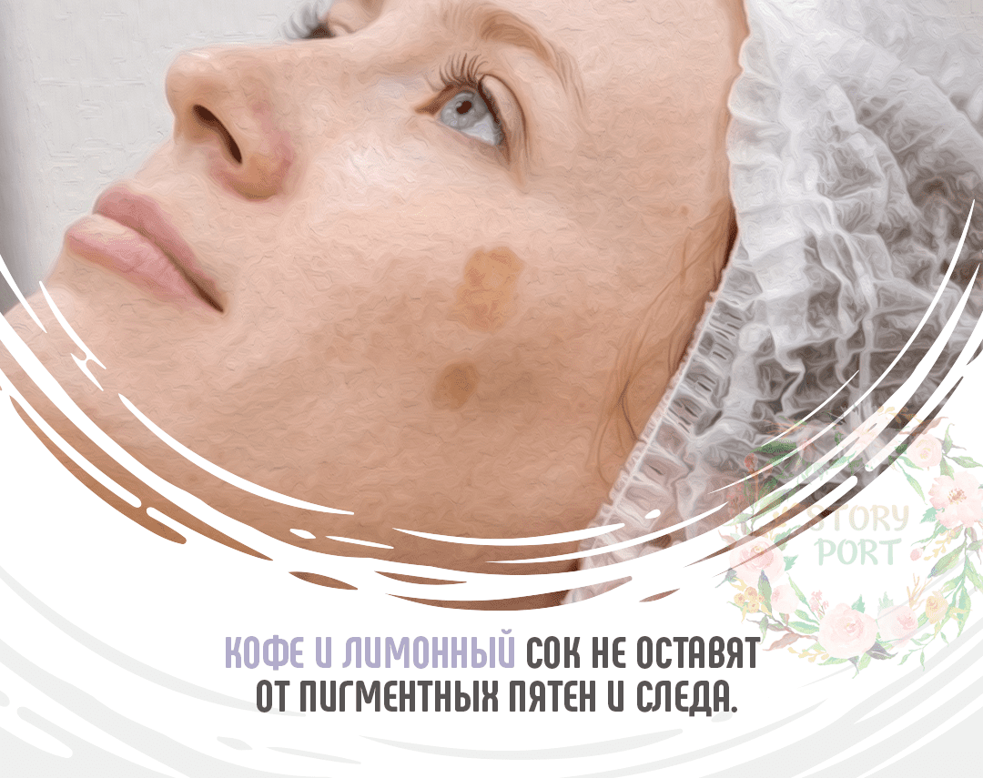 Борьба с пигментными пятнами в домашних условиях