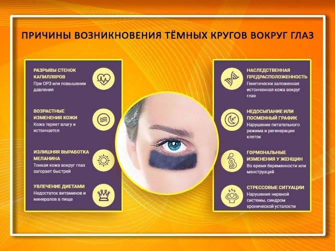 Как убрать синяки под глазами? причины появления и методы избавиться от темных кругов под глазами