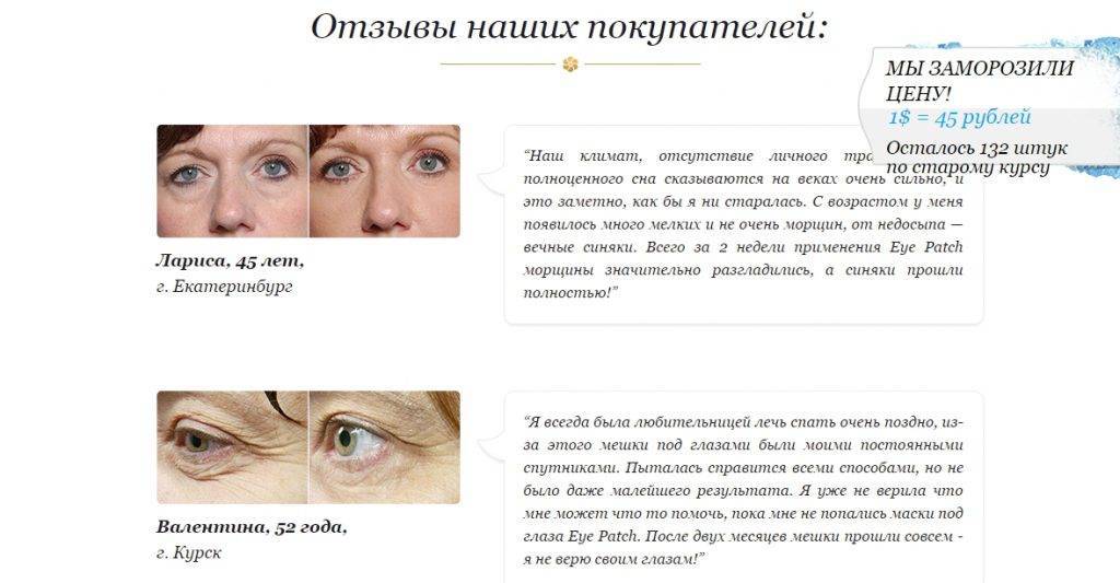 Как быстро убрать отеки под глазами в домашних условиях