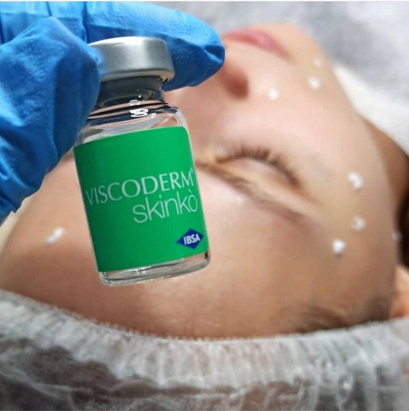 Биоревитализация препаратом viscoderm skinko: отзывы