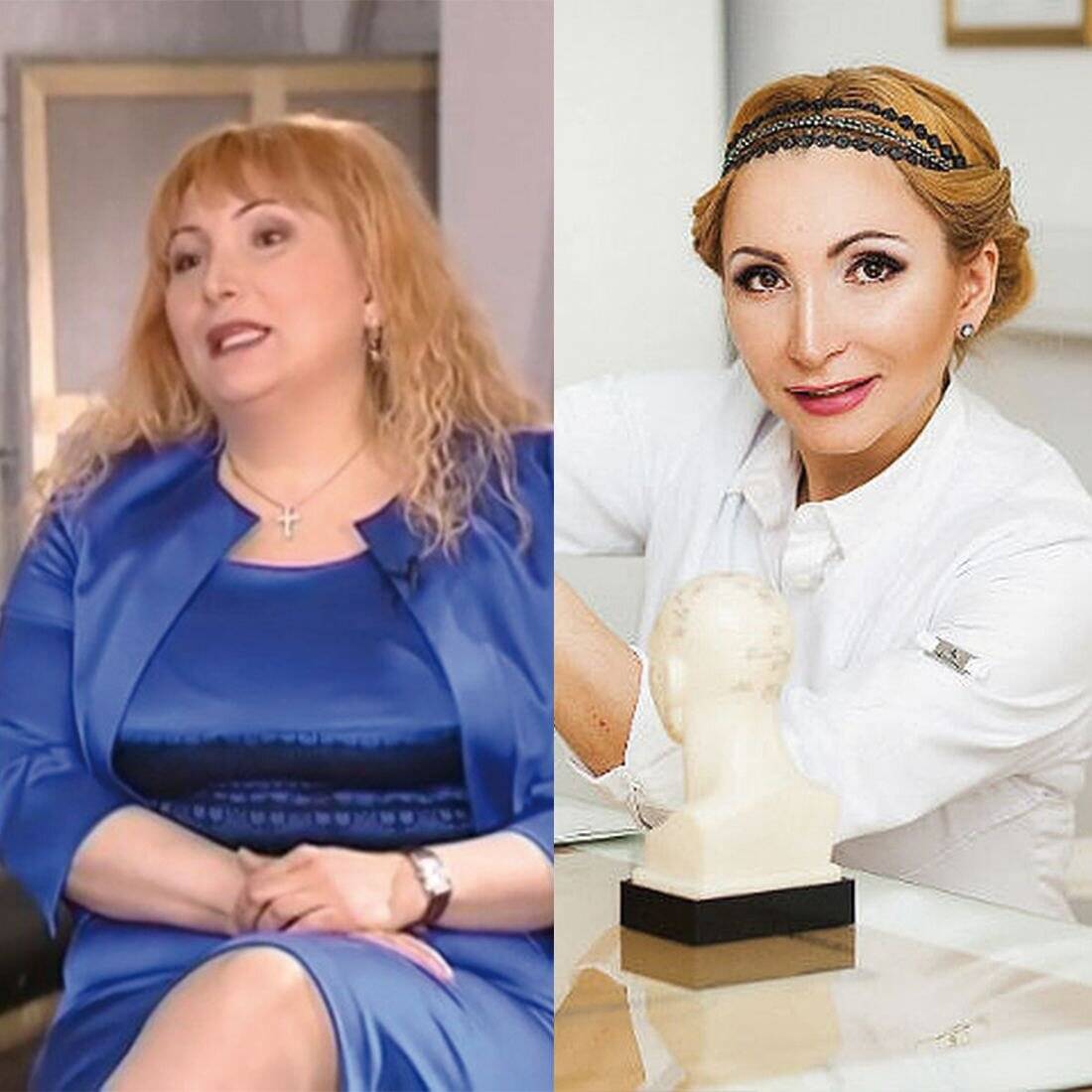 Игла для похудения- акупунктурная методика м. мухиной