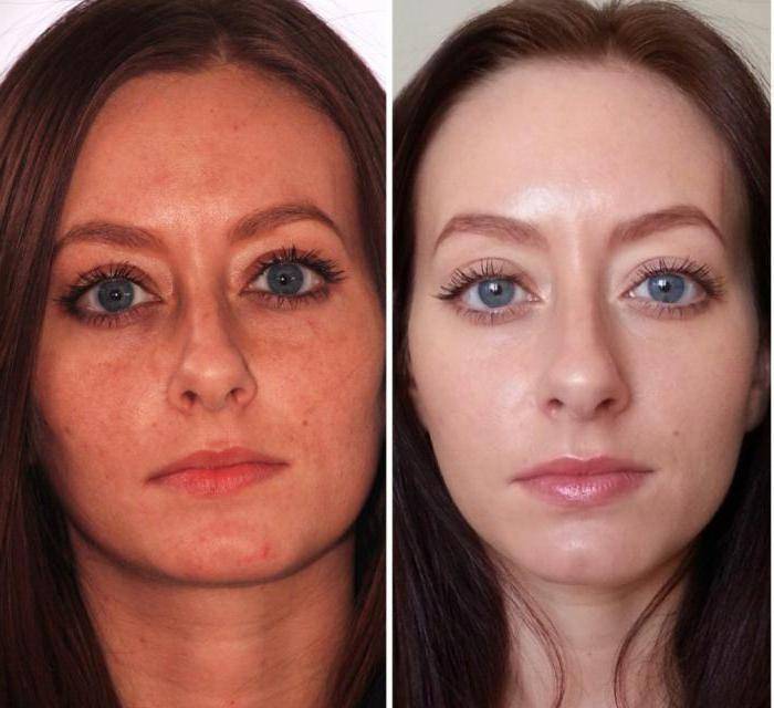 Mask miracle glow: negative reviews, positive reviews. opinions of real users