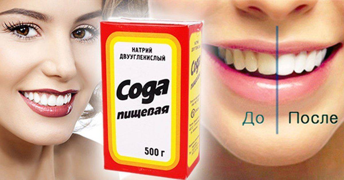 Отбеливание зубов содой в домашних условиях – противопоказания к процедуре