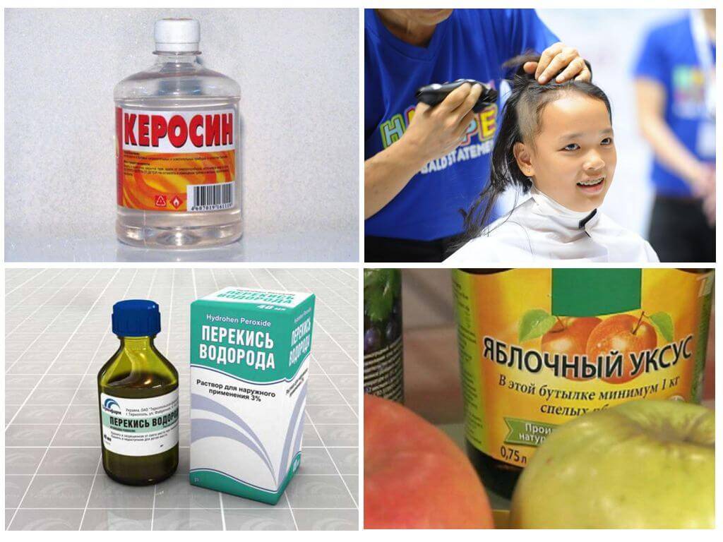 Как вывести керосином вшей и гнид