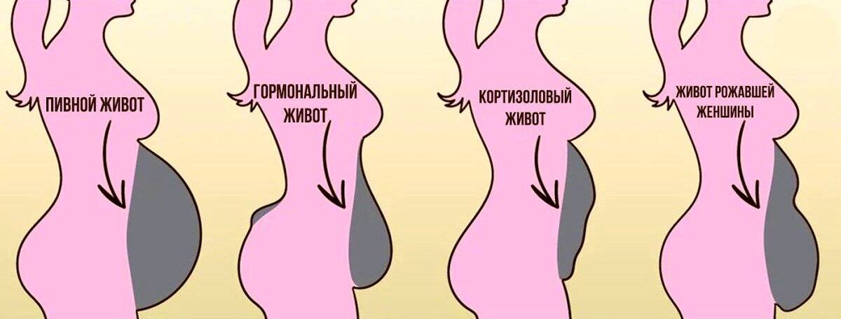 Как убрать кортизоловый живот. кортизоловый живот: почему появляется и как избавиться от стрессового жира | я худею