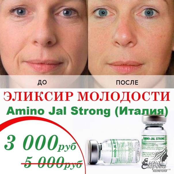 Amino jal: биоревитализация по-итальянски