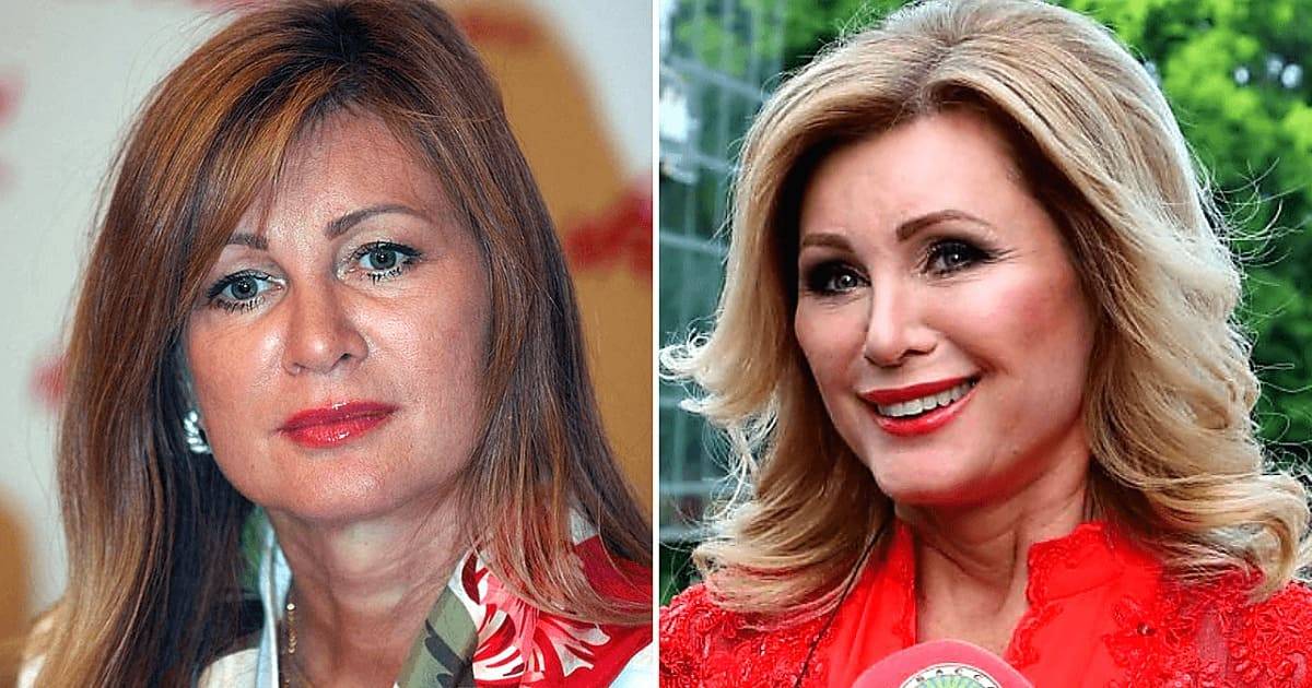 Вика цыганова до и после пластики, откровенные фото