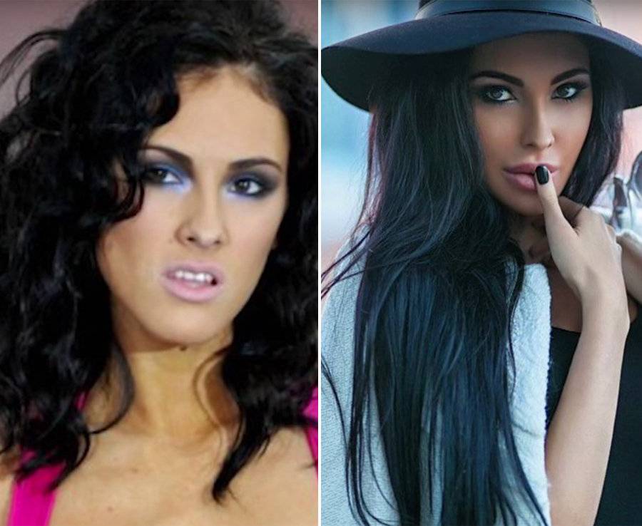 Malinskaya olesya before and after plastic surgery (photo). biography, personal life, interesting facts
