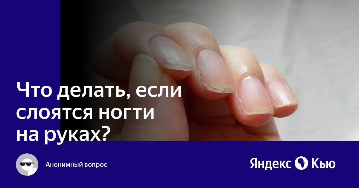 Слоятся ногти, что делать в домашних условиях