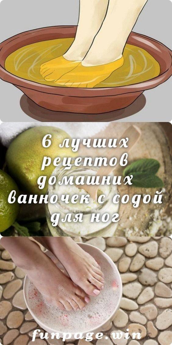 Трещины на пятках — причины и лечение народными средствами у мужчин и женщин